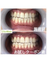 ルブラン 奈良店(Le Blanc)/第一印象は、歯！で決まる！