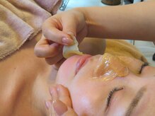 大人気天然マツヤニwax◎産毛除去/顔ダニ除去/肌質改善