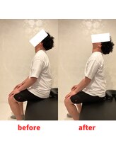 ナオル整体 福岡香椎院(NAORU整体)/30代男性施術事例【首の痛み】