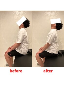 ナオル整体 福岡香椎院(NAORU整体)/30代男性施術事例【首の痛み】