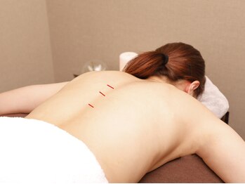 リアン(Re.en)/即効性、結果重視を望む方◎