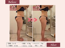 リムサロン(RIMSALON)/