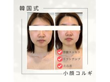 お客様のお悩みに合わせた韓国式オーダーメイドコルギ！！