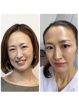 ファームディ(Pharm.D)/肌質改善☆