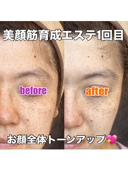 リエル(RIEL)/【美顔筋育成】