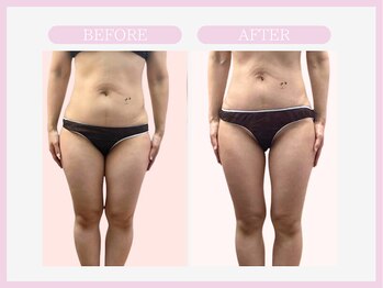 スリムライン 秋田店(The Slim Line)/before→after