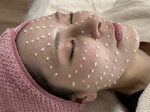 CICAエクソソームをお肌に植え付け土台から本来の美しい肌へ♪