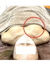 ルミエール(Lumiere)/【倉敷市】バストアップ施術事例