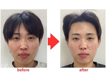 ブプラ 小倉店(BUPURA)/