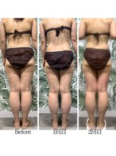 バイブスプラス(Vibes+)/