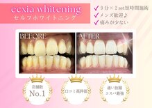 エクシアホワイトニング 京都二条店
