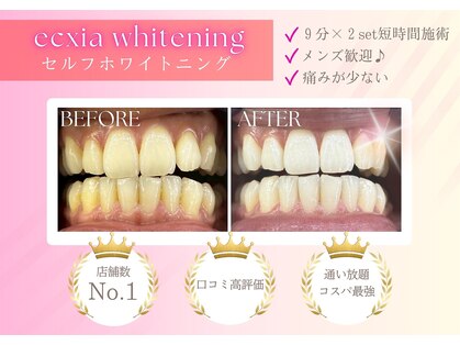 エクシアホワイトニング 京都二条店の写真