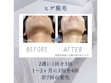 アールビーオム 六本木(RB HOMMU)の写真