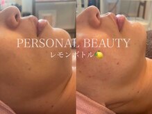 PB/レモンボトル