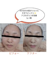 一呼休/フェイシャルエステ