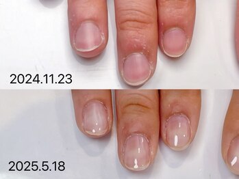 キラネイル アンド アイラッシュ by World Beauty(KIRA)/新潟自爪育成