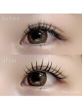 トレース(tres)/バインドロック