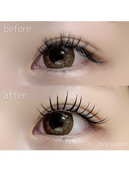 トレース(tres)/バインドロック