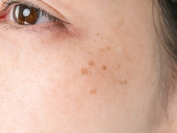 オルディーネ(ORUDiNE)の写真/【本気のエイジングケア】再生美容で肌土台から根本改善！シミ・しわをケアして、未来の自分に自信を。