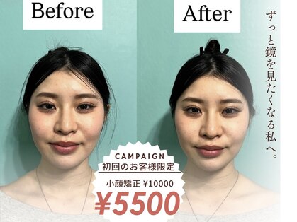 ハチ(HACHI)の写真