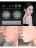 2) 【速攻リフト】次世代小顔タイトニング*サーマル 新規¥12,000 再来¥18,000