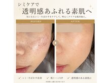 ミエリー(miely)の雰囲気(最新光フェイシャルでシミケア!お顔のクレンジングできます☆)