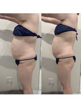 ベリッセ(Belisse)/ダイエットならお任せ！！