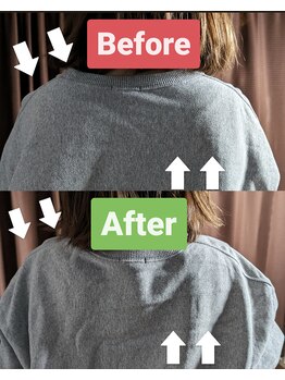 松 中目黒/30代女性 首肩こり/猫背の改善例