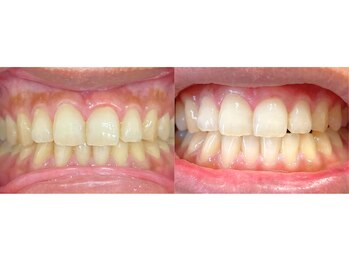 ラクーン(RACCOON)/