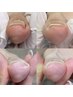 【初回】フット巻き爪・割れ爪補正　２ヶ所　60分　13,200円→11,000円