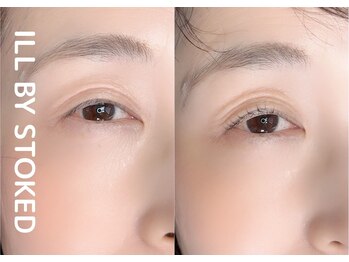 アイル バイ ストーク(I’LL by STOKED)/まつげパーマ・ラッシュリフト☆