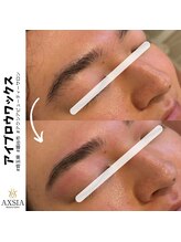 アクシア ビューティー サロン(AXSIA)/【HBL】BeforeAfter