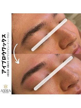 アクシア ビューティー サロン(AXSIA)/【HBL】BeforeAfter