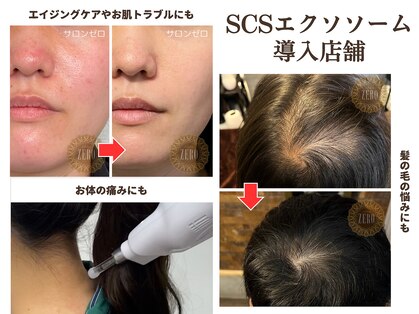 サロンゼロ 池上店(Salon ZERO)の写真