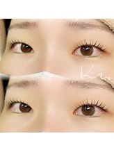 クレー(Klee)/ラッシュリフト