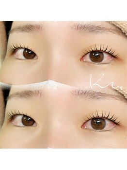 クレー(Klee)/ラッシュリフト