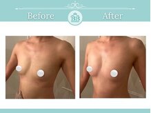 美人バスト 新潟店/ 【バストアップ★育乳】症例