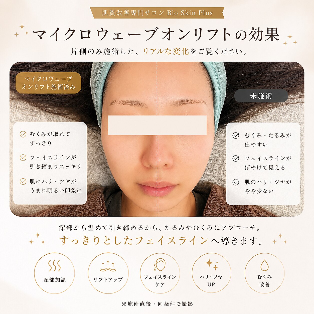 バイオ スキン プラス(Bio Skin Plus)｜ホットペッパービューティー