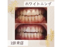 りあふ(Raf)/真っ白な歯で笑顔に自信を