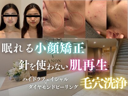 ラノン(LANON)の写真