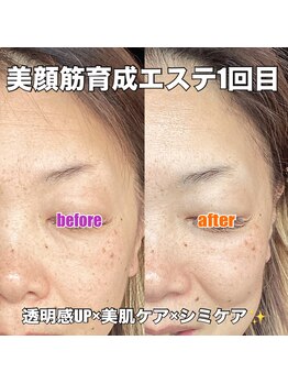 リエル(RIEL)/【美顔筋育成】