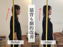 アライメントトウキョウ 麻布十番(Alignment TOKYO)/猫背改善で若々しく☆