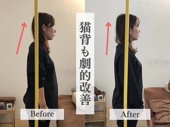 アライメントトウキョウ 麻布十番(Alignment TOKYO)/猫背改善で若々しく☆
