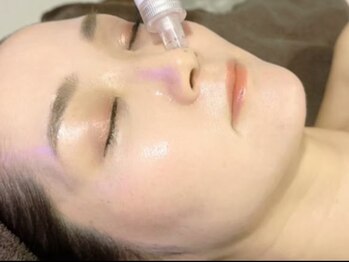 ルル 北仙台の写真/最新マシンを使った【毛穴洗浄】で毛穴の黒ずみや古い角質などをごっそり除去◎肌への負担も最小限な施術！