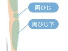 ボス 桑名駅前店(BOSS)/ 【メンズ脱毛/上半身・両肘下】