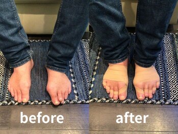 整足院/テーピング後