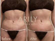 アリリィ(ARILY)/ARILY after care salon