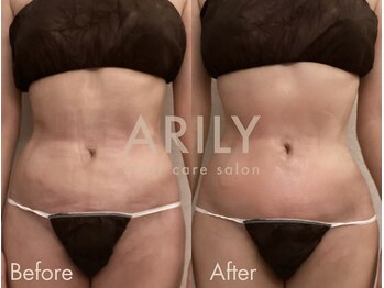 アリリィ(ARILY)/ARILY after care salon