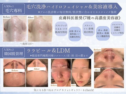 フレイヤ(FREYA)の写真