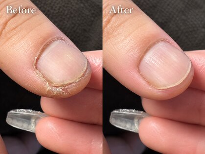 メンズ ネイル トノ(Men's Nail TONO)の写真